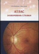 Атлас захворювань сітківки