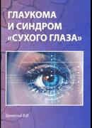 Глаукома и синдром 
