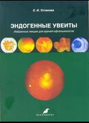 Эндогенные увеиты