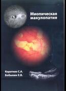 Миопическая макулопатия