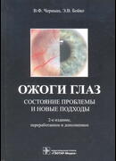 Ожоги глаз. Состояние проблемы и новые подходы. 2-е издание