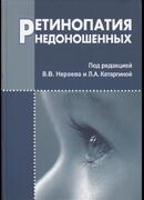 Ретинопатия недоношенных