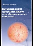 Застойные диски зрительных нервов и их дифференциальная диагностика