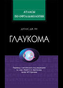 Глаукома