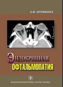 Эндокринная офтальмопатия