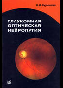 Глаукомная оптическая нейропатия