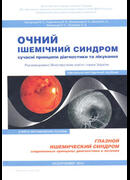 Глазной ишемический синдром. Современные принципы диагностики и лечения