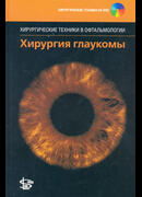 Хирургия глаукомы