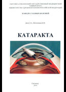 Катаракта