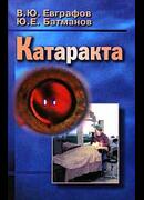 Катаракта