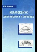 Кератоконус: диагностика и лечение