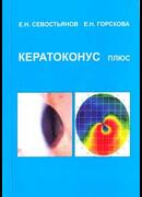 Кератоконус плюс