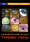 Клинический атлас травмы глаза