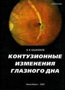 Контузионные изменения глазного дна