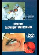 Лазерная дакриоцисториностомия