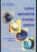 Лазерная микрохирургия зрачковых мембран