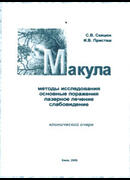 Макула