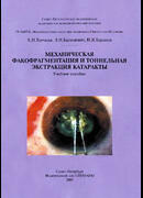 Механическая факофрагментация и тоннельная экстракция катаракты