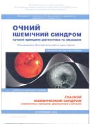 Очний ішемічний синдром. Сучасні принципи діагностики та лікування