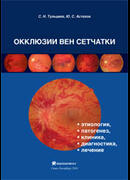 Окклюзии вен сетчатки (этиология, патогенез, клиника, диагностика, лечение)