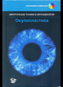 Окулопластика