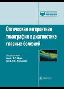 Оптическая когерентная томография в диагностике глазных болезней
