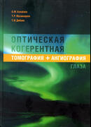 Оптическая когерентная томография + ангиография глаза