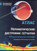 Периферические дистрофии сетчатки. Оптическая когерентная томография. Лазерная коагуляция сетчатки: атлас