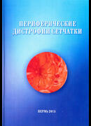 Периферические дистрофии сетчатки