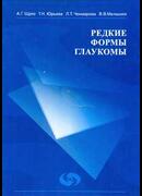 Редкие формы глаукомы