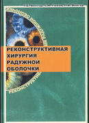 Реконструктивная хирургия радужной оболочки (иридопластика и иридопротезирование)