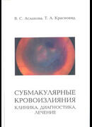 Субмакулярные кровоизлияния. Клиника, диагностика, лечение