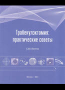 Трабекулэктомия: практические советы