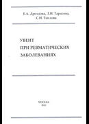 Увеит при ревматических заболеваниях