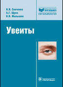 Увеиты