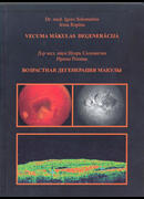 Возрастная дегенерация макулы