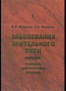 Заболевания зрительного пути: Клиника. Диагностика. Лечение