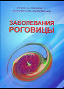 Заболевания роговицы
