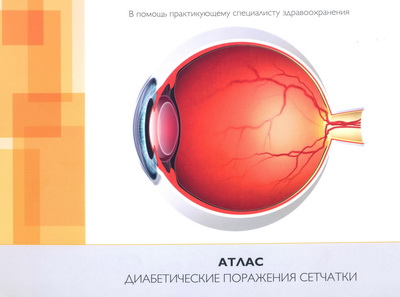Атлас. Диабетические поражения сетчатки