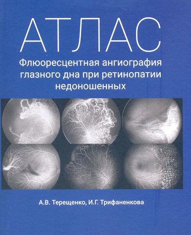 Атлас.Флюоресцентная ангиография глазного дна при ретинопатии недоношенных