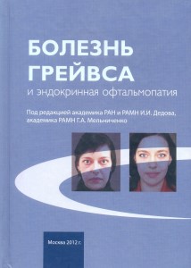 Болезнь Грейвса и эндокринная офтальмопатия
