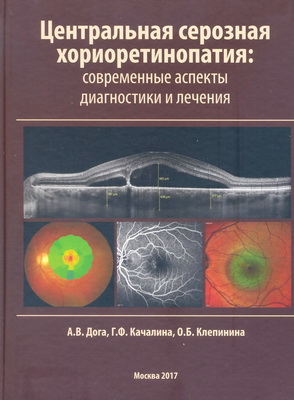Центральная серозная хориоретинопатия: современные аспекты диагностики и лечения