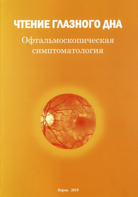 Чтение глазного дна. Офтальмоскопическая симптоматология. 2-е издание