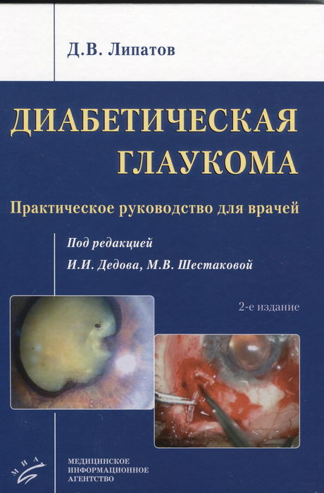 Диабетическая глаукома. Практическое руководство для врачей. 2-е издание