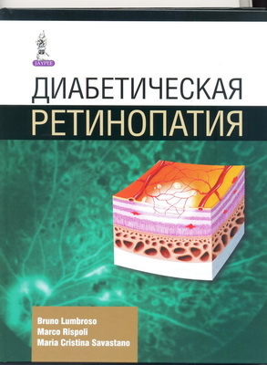 Диабетическая ретинопатия