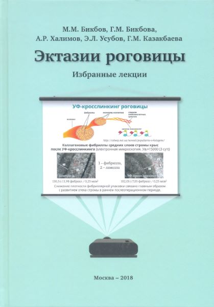 Эктазии роговицы. Избранные лекции