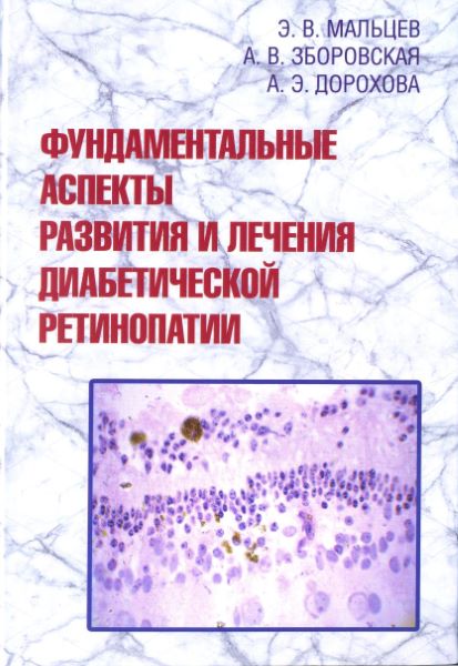 Фундаментальные аспекты развития и лечения диабетической ретинопатии