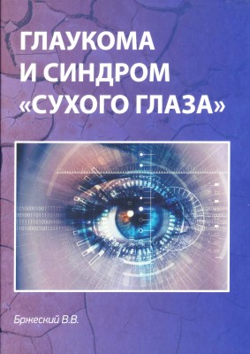 Глаукома и синдром 