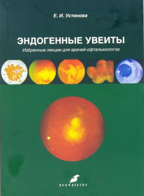 Эндогенные увеиты