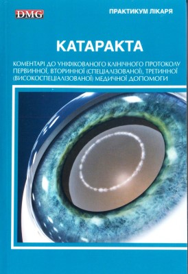 Катаракта. Коментарі до уніфікованого клінічного протоколу первинної, вторинної (спеціалізованої), третинної (високоспеціалізованої) медичної допомоги